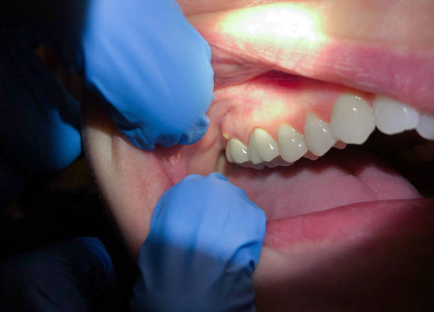 Best Weekend Emergency Dental Services in Roberts, WI